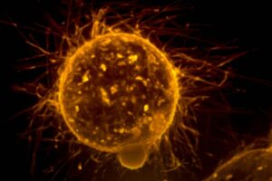 national-cancer-institute-vv-ycnzesag-unsplash-1536x1223