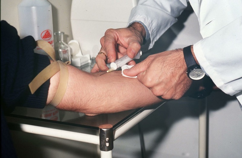 Un análisis genético podría detectar el párkinson antes de los primeros síntomas